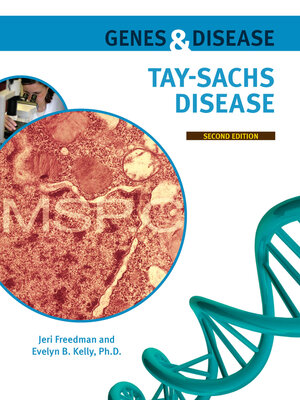 cover image of Tay-Sachs Disease